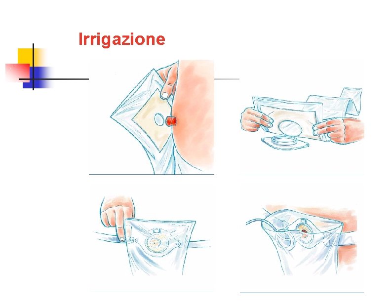 Irrigazione 