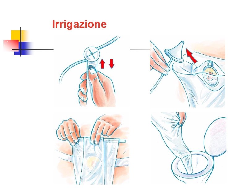 Irrigazione 