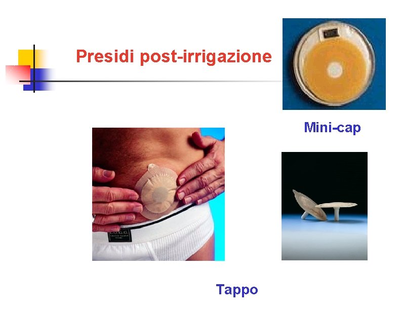 Presidi post-irrigazione Mini-cap Tappo 