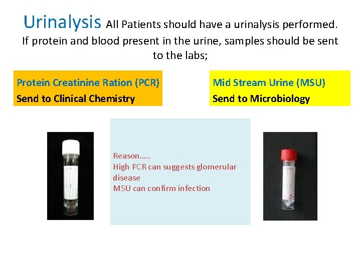 Urinalysis All Patients should have a urinalysis performed. If protein and blood present in