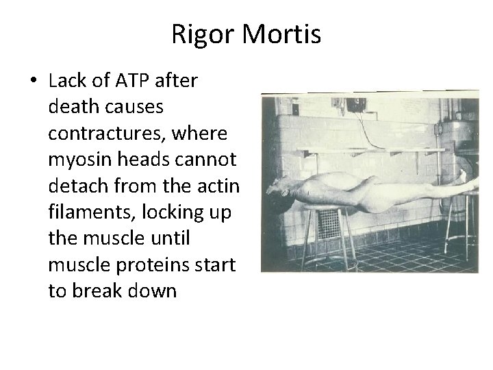 Rigor Mortis • Lack of ATP after death causes contractures, where myosin heads cannot