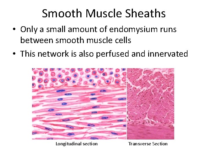 Smooth Muscle Sheaths • Only a small amount of endomysium runs between smooth muscle