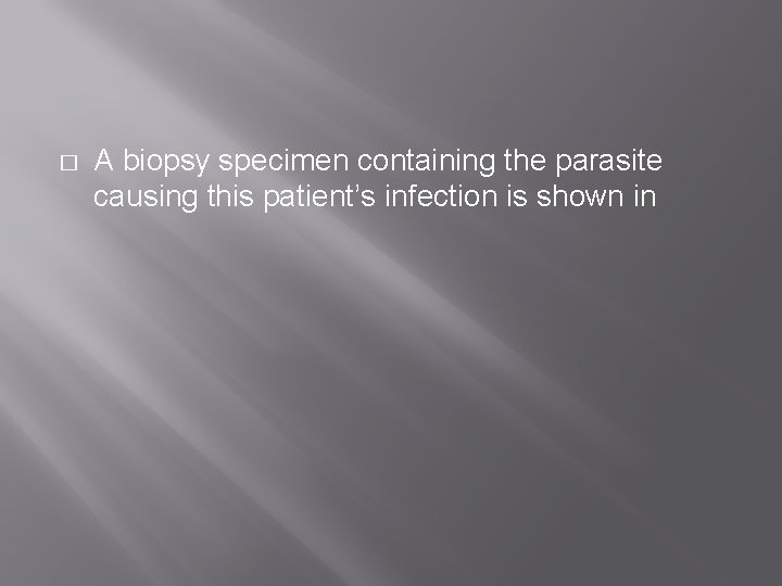 � A biopsy specimen containing the parasite causing this patient’s infection is shown in