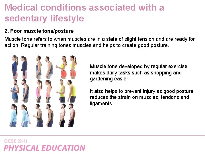 Medical conditions associated with a sedentary lifestyle 2. Poor muscle tone/posture Muscle tone refers