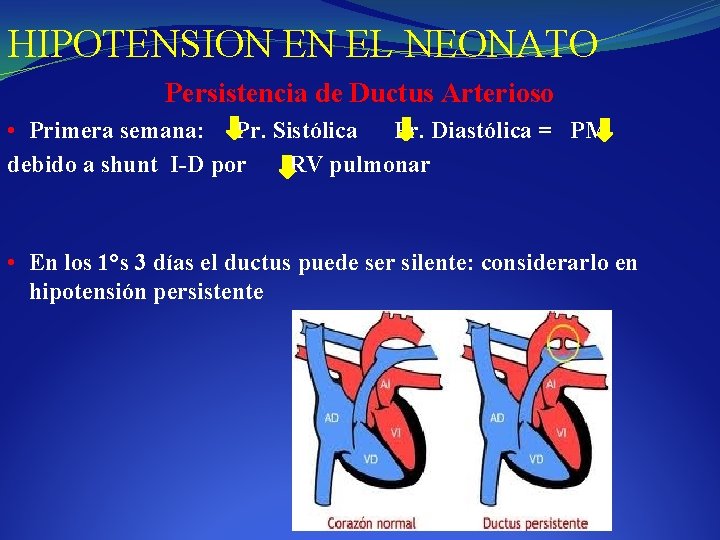 HIPOTENSION EN EL NEONATO Persistencia de Ductus Arterioso • Primera semana: Pr. Sistólica Pr.