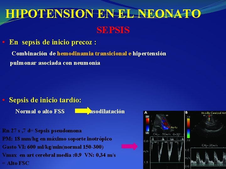 HIPOTENSION EN EL NEONATO SEPSIS • En sepsis de inicio precoz : Combinación de