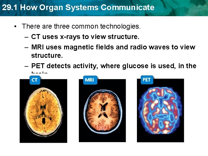 29. 1 How Organ Systems Communicate • There are three common technologies. – CT