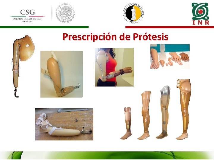 Prescripción de Prótesis 