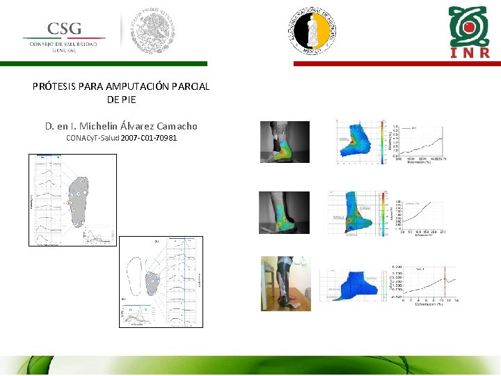 PRÓTESIS PARA AMPUTACIÓN PARCIAL DE PIE D. en I. Michelín Álvarez Camacho CONACy. T-Salud