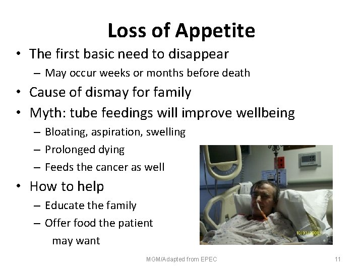 Loss of Appetite • The first basic need to disappear – May occur weeks