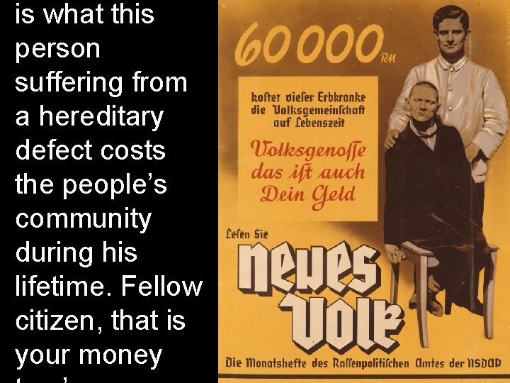 is what this person suffering from a hereditary defect costs the people’s community during is what this person suffering from a hereditary defect costs the people’s community during