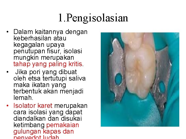1. Pengisolasian • Dalam kaitannya dengan keberhasilan atau kegagalan upaya penutupan fisur, isolasi mungkin 1. Pengisolasian • Dalam kaitannya dengan keberhasilan atau kegagalan upaya penutupan fisur, isolasi mungkin