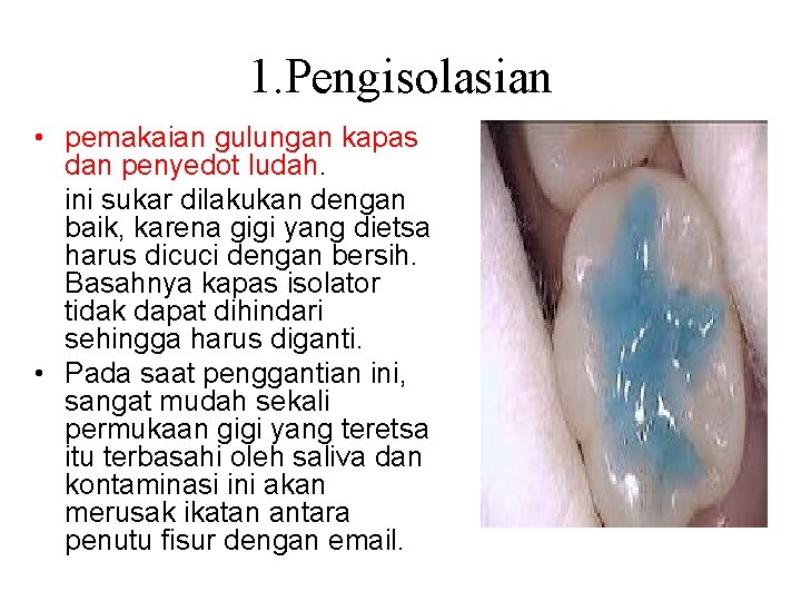 1. Pengisolasian • pemakaian gulungan kapas dan penyedot ludah. ini sukar dilakukan dengan baik, 1. Pengisolasian • pemakaian gulungan kapas dan penyedot ludah. ini sukar dilakukan dengan baik,