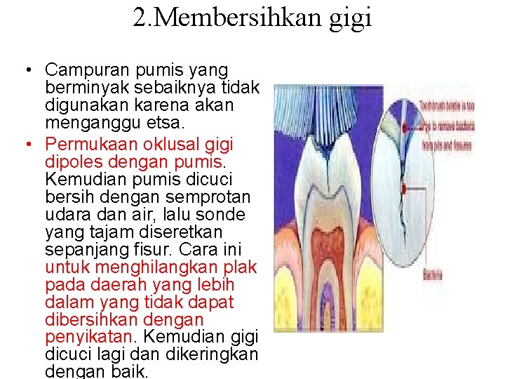 2. Membersihkan gigi • Campuran pumis yang berminyak sebaiknya tidak digunakan karena akan menganggu 2. Membersihkan gigi • Campuran pumis yang berminyak sebaiknya tidak digunakan karena akan menganggu