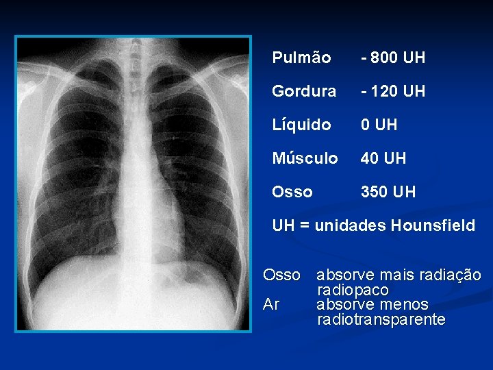 Pulmão - 800 UH Gordura - 120 UH Líquido 0 UH Músculo 40 UH
