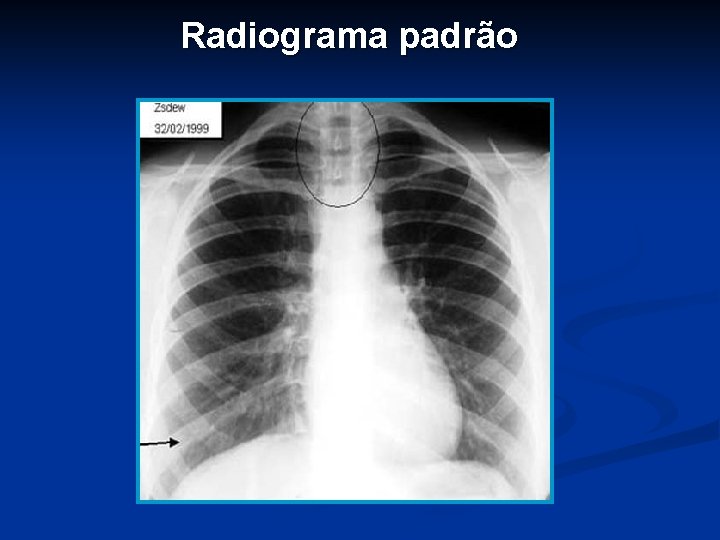 Radiograma padrão 