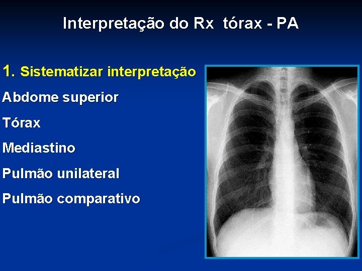 Interpretação do Rx tórax - PA 1. Sistematizar interpretação Abdome superior Tórax Mediastino Pulmão