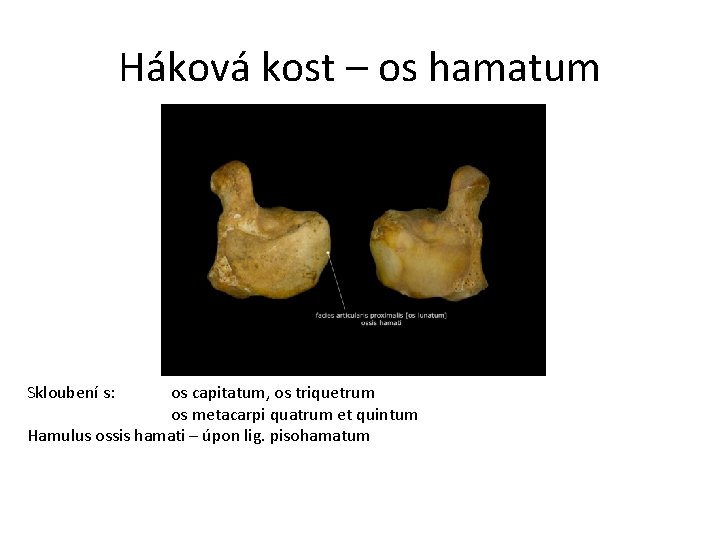 Háková kost – os hamatum Skloubení s: os capitatum, os triquetrum os metacarpi quatrum