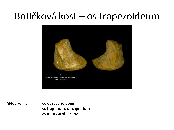 Botičková kost – os trapezoideum Skloubení s: os os scaphoideum os trapezium, os capitatum