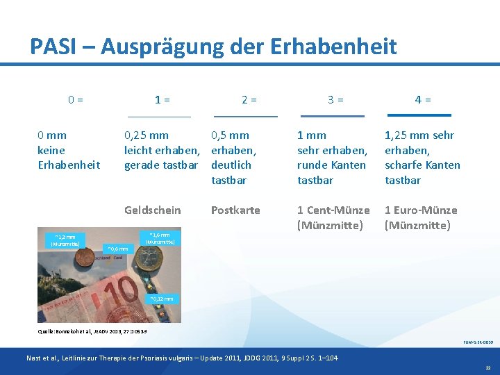 PASI – Ausprägung der Erhabenheit 3= 4= 0, 25 mm 0, 5 mm leicht