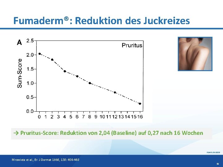 Fumaderm®: Reduktion des Juckreizes → Pruritus-Score: Reduktion von 2, 04 (Baseline) auf 0, 27