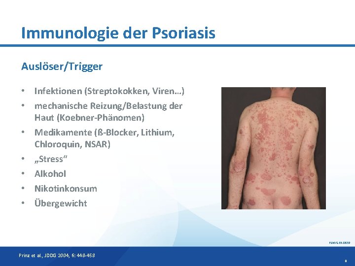 Immunologie der Psoriasis Auslöser/Trigger • Infektionen (Streptokokken, Viren…) • mechanische Reizung/Belastung der Haut (Koebner-Phänomen)