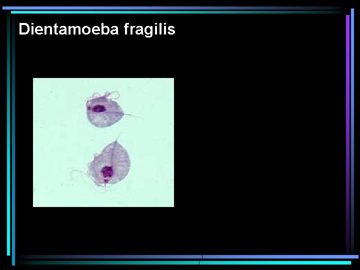 Dientamoeba fragilis 