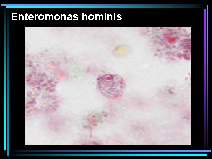 Enteromonas hominis 