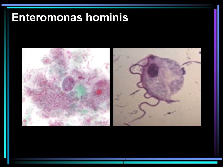 Enteromonas hominis 