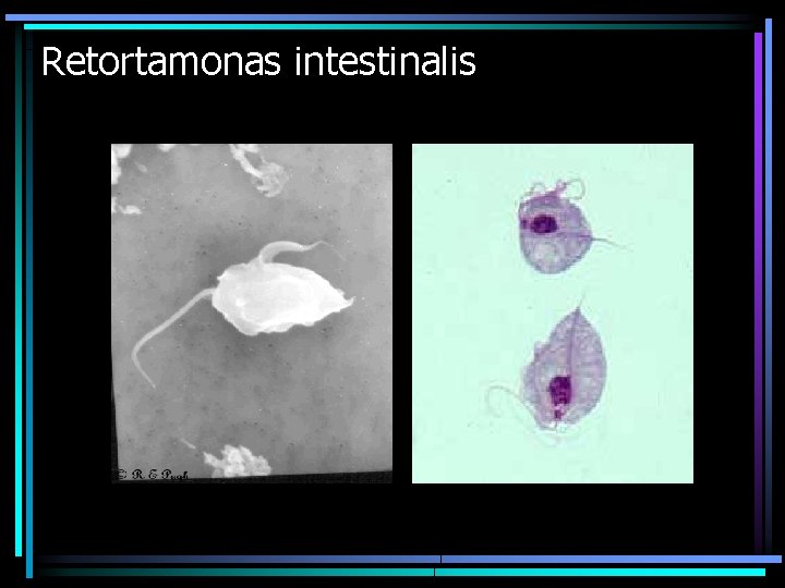 Retortamonas intestinalis 