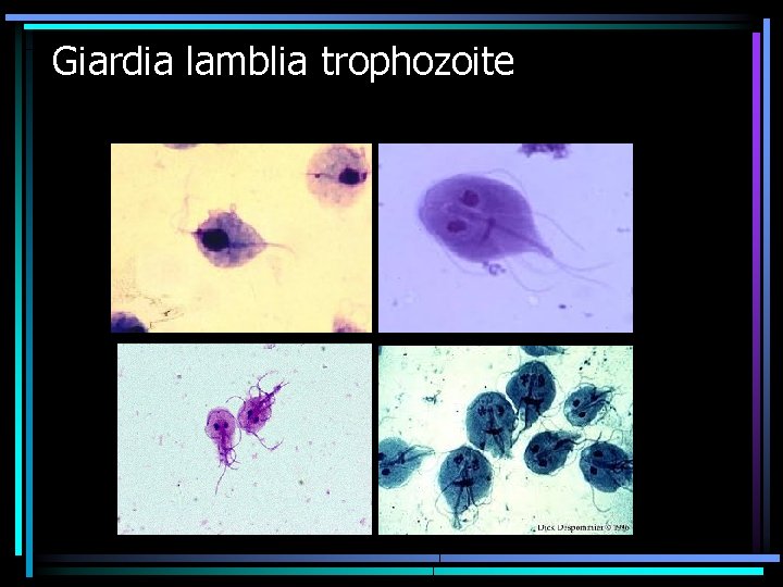 Giardia lamblia trophozoite 