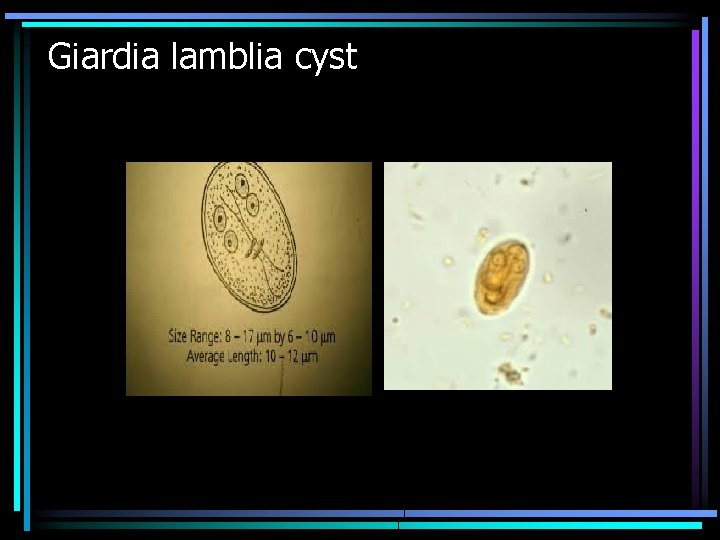 Giardia lamblia cyst 