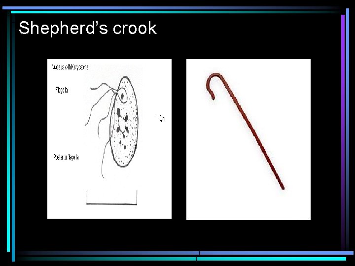 Shepherd’s crook 