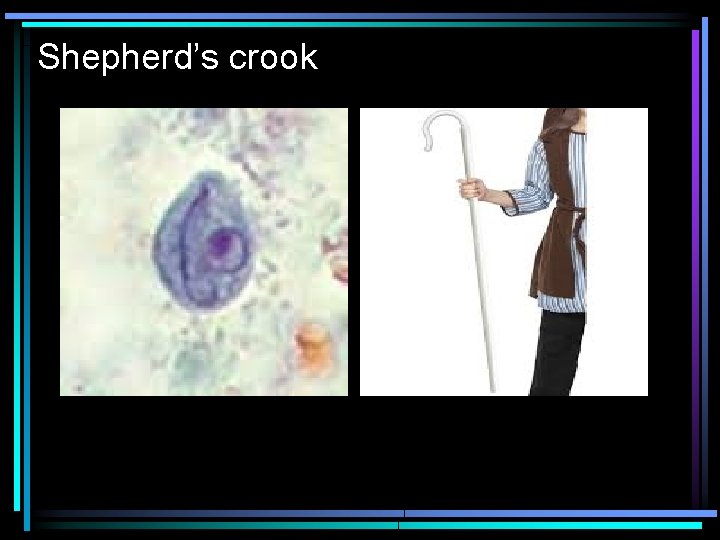 Shepherd’s crook 