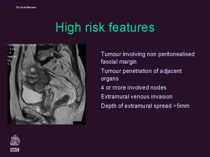 The Royal Marsden High risk features • • Tumour involving non peritonealised fascial margin