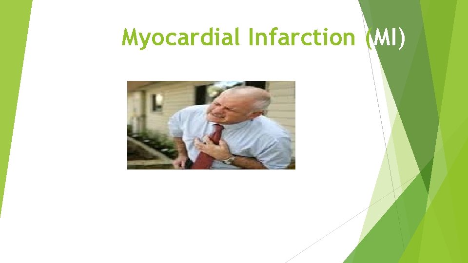 Myocardial Infarction (MI) 