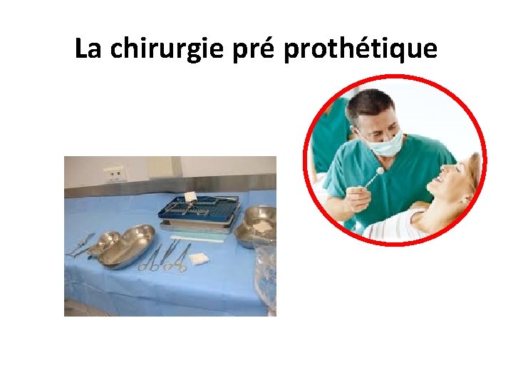 La chirurgie pré prothétique 