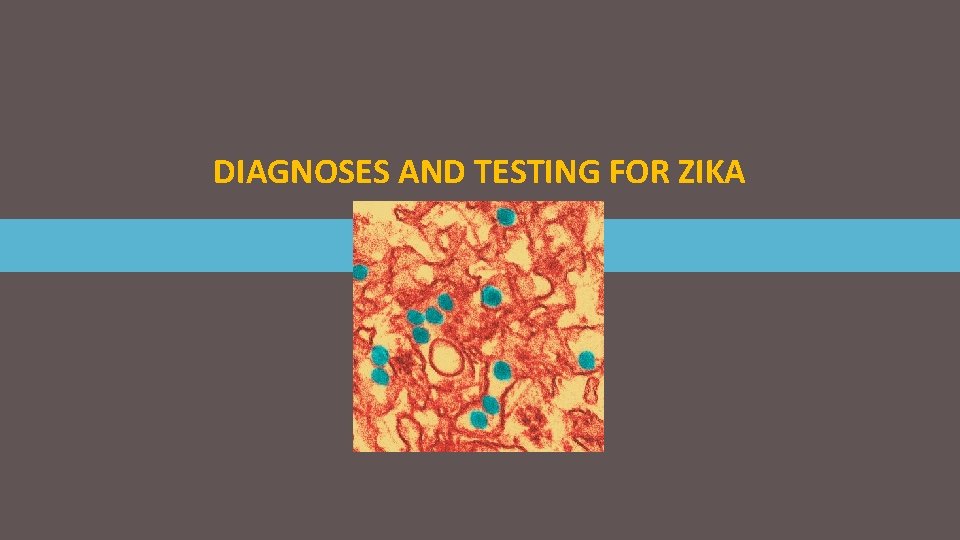 DIAGNOSES AND TESTING FOR ZIKA 