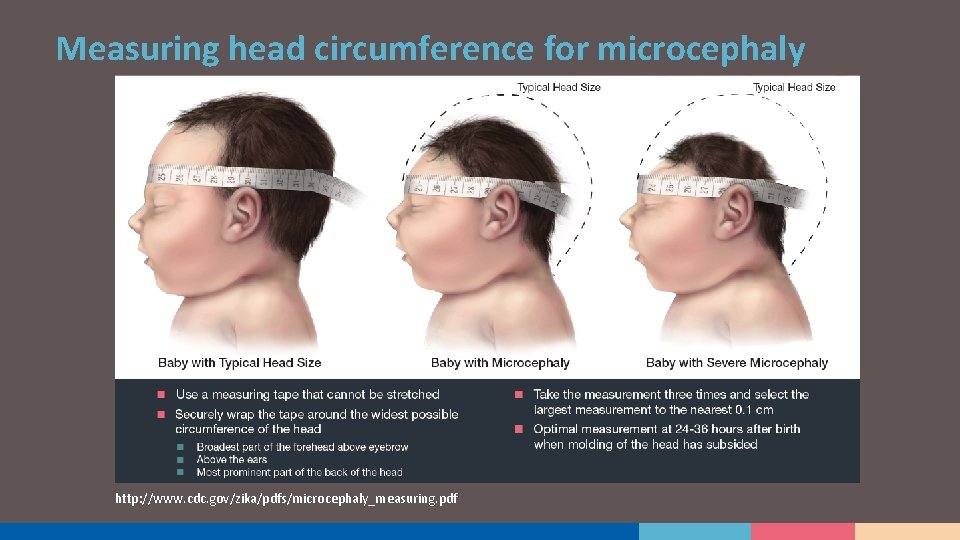 Measuring head circumference for microcephaly http: //www. cdc. gov/zika/pdfs/microcephaly_measuring. pdf 