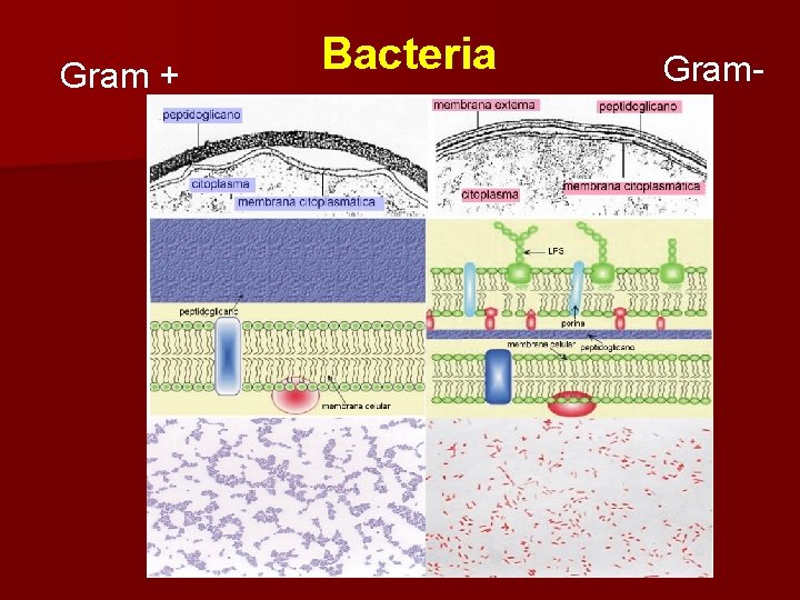 Gram + Bacteria Gram- 