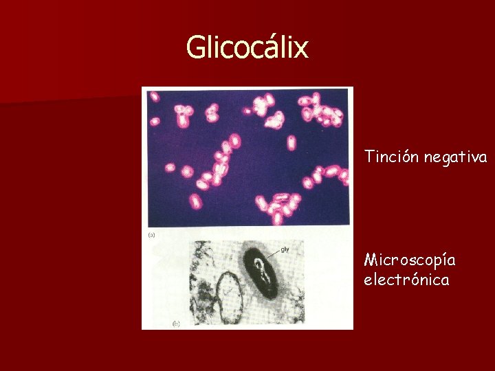 Glicocálix Tinción negativa Microscopía electrónica 