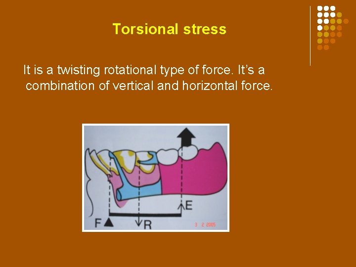 Torsional stress It is a twisting rotational type of force. It’s a combination of