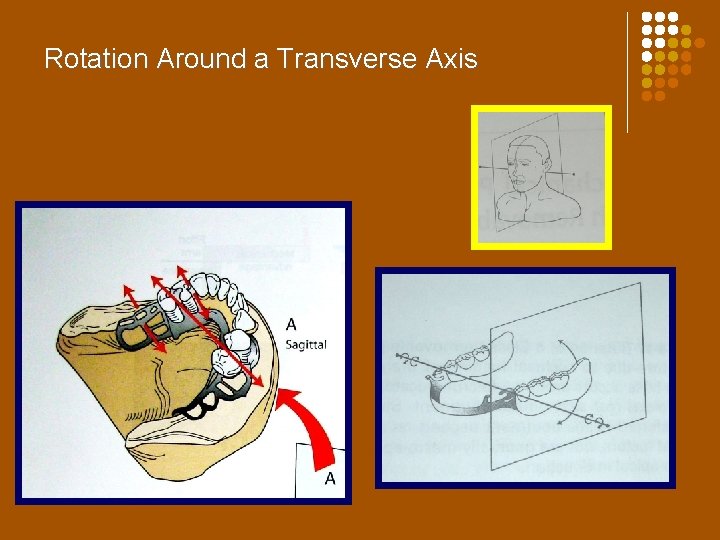 Rotation Around a Transverse Axis 