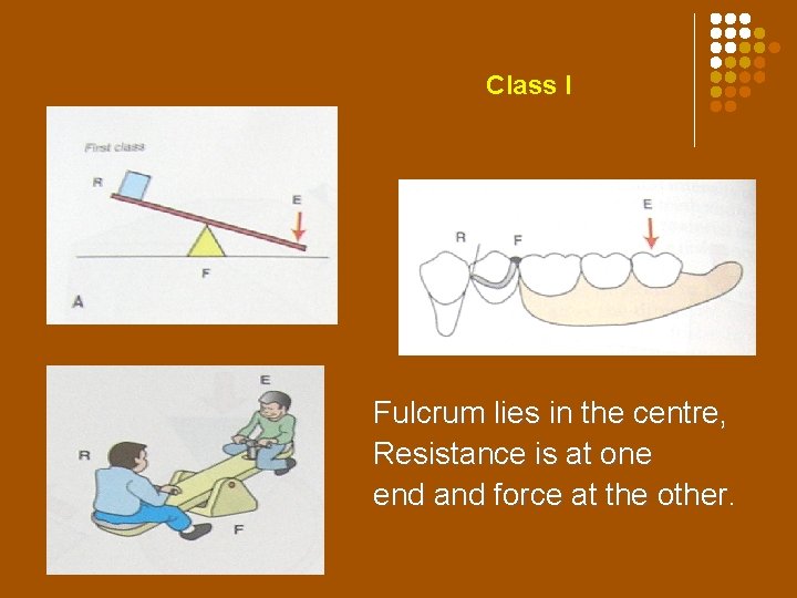 Class I lever Class I Fulcrum lies in the centre, Resistance is at one