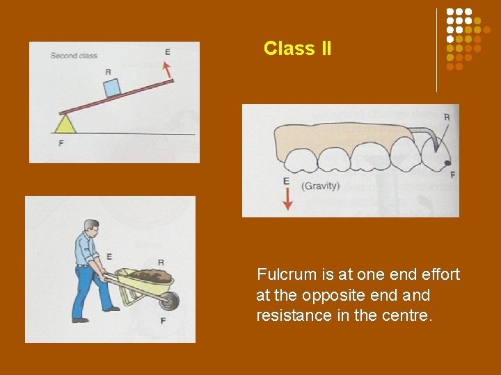 Class II lever Class II Fulcrum is at one end effort at the opposite