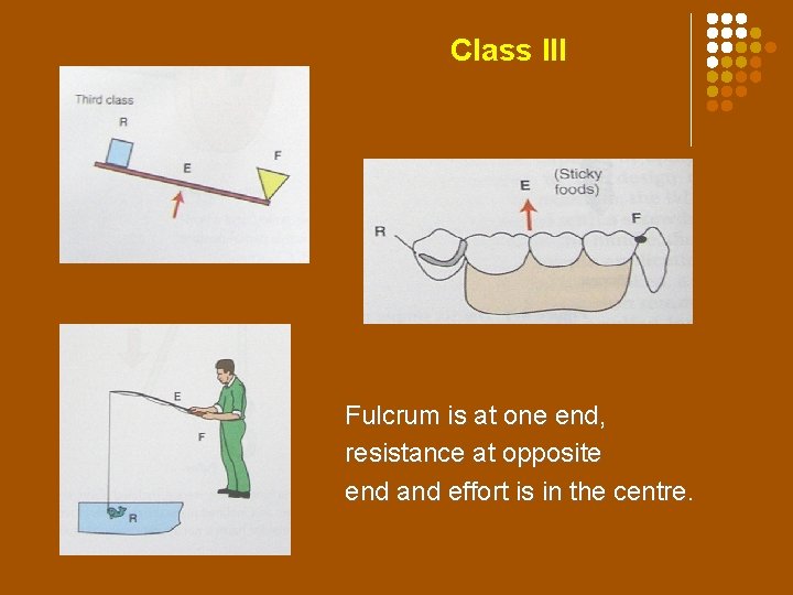 Class III lever Class III Fulcrum is at one end, resistance at opposite end