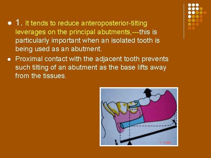 l l 1. It tends to reduce anteroposterior-tilting leverages on the principal abutments, ---this