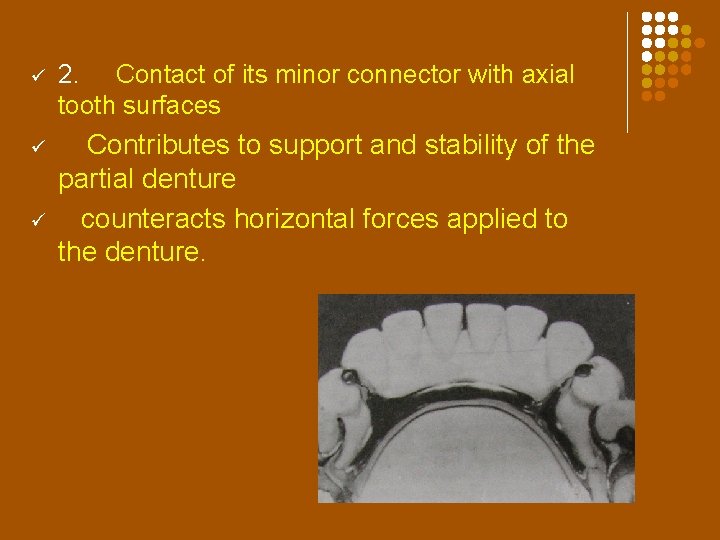 ü 2. Contact of its minor connector with axial tooth surfaces ü Contributes to