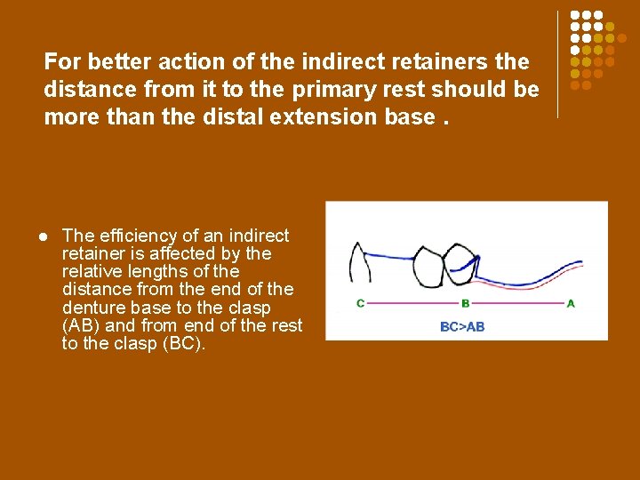 For better action of the indirect retainers the distance from it to the primary