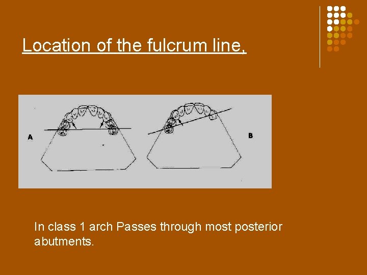 Location of the fulcrum line, In class 1 arch Passes through most posterior abutments.